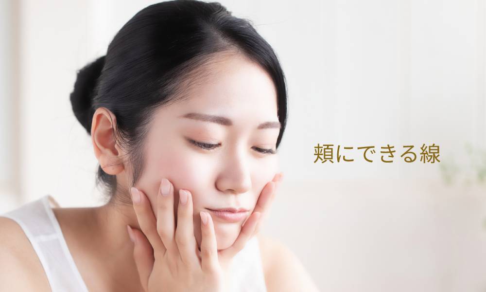 頬にできる線